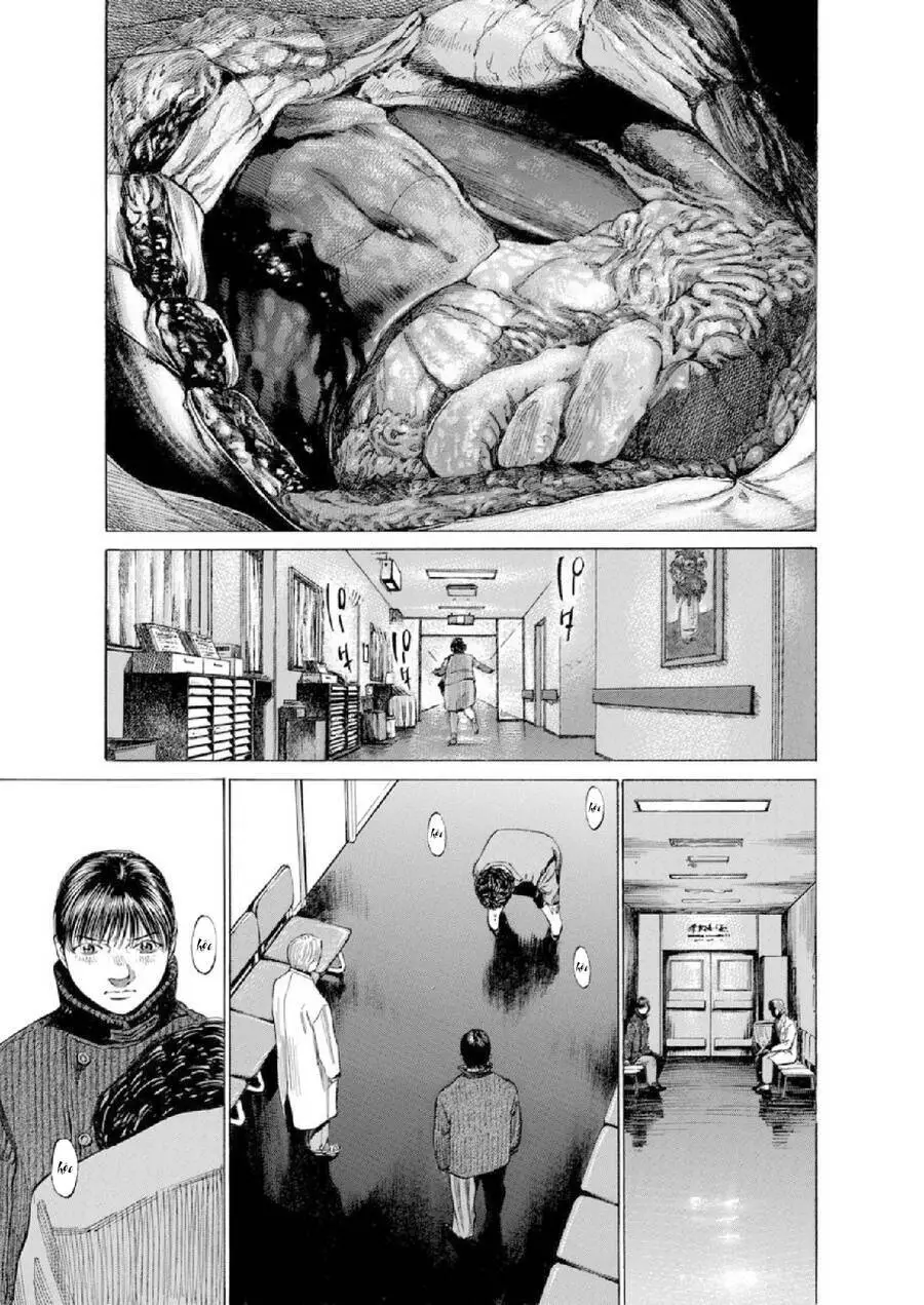 Give My Regards To Black Jack Nettruyen ZZZ Chương 115 Page 8