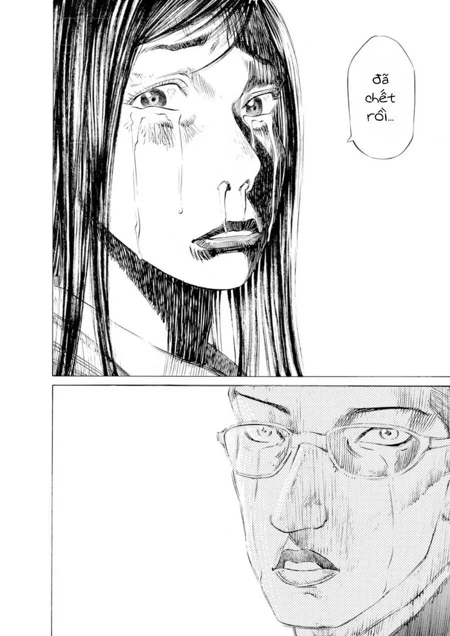 Give My Regards To Black Jack Nettruyen ZZZ Chương 33 Page 15