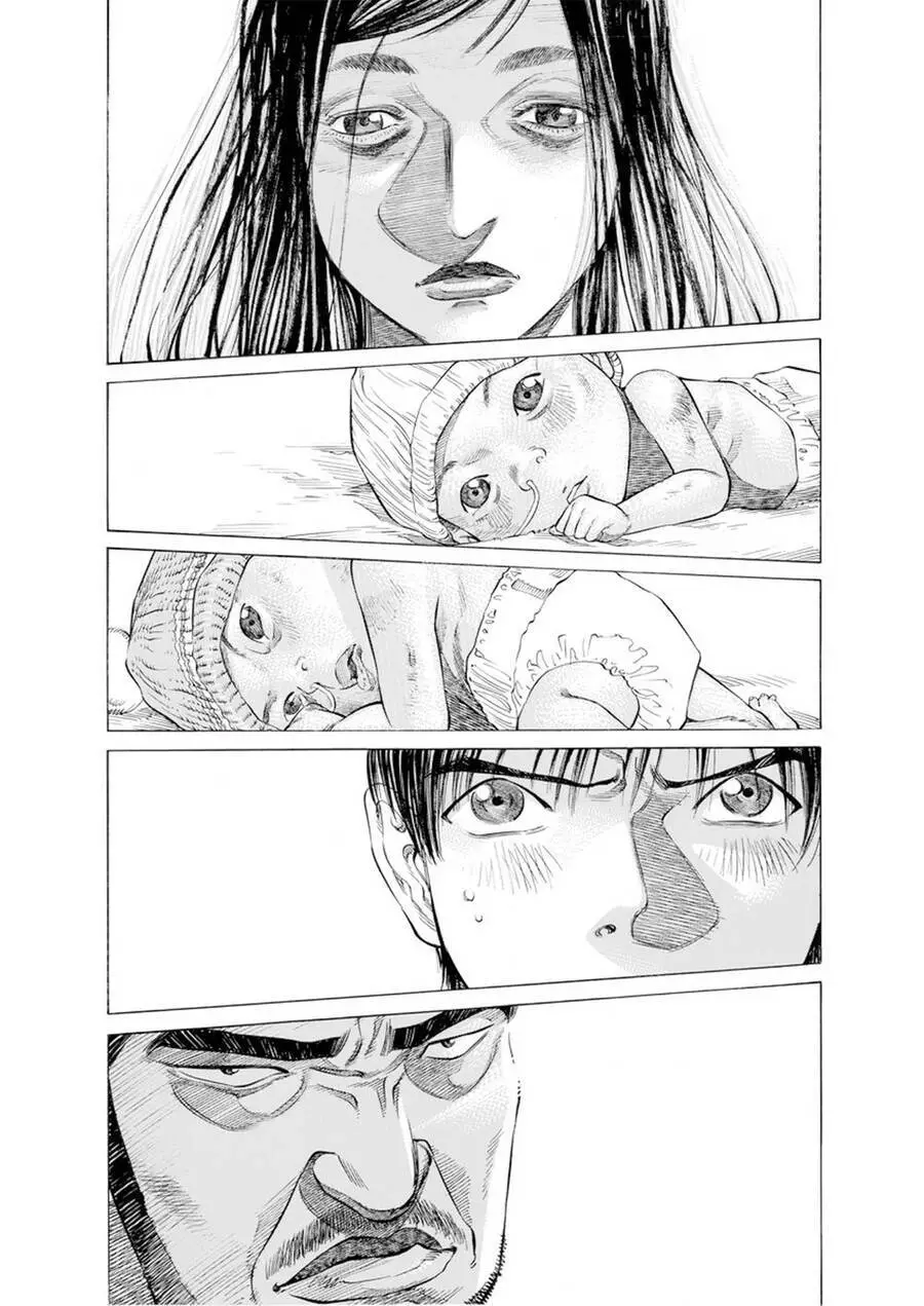 Give My Regards To Black Jack Nettruyen ZZZ Chương 26 Page 4