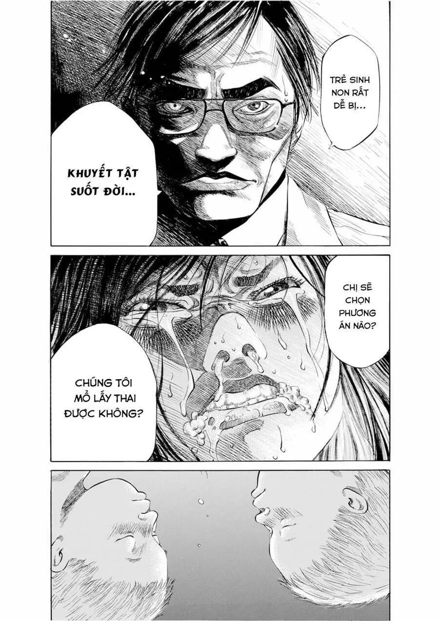 Give My Regards To Black Jack Nettruyen ZZZ Chương 21 Page 7