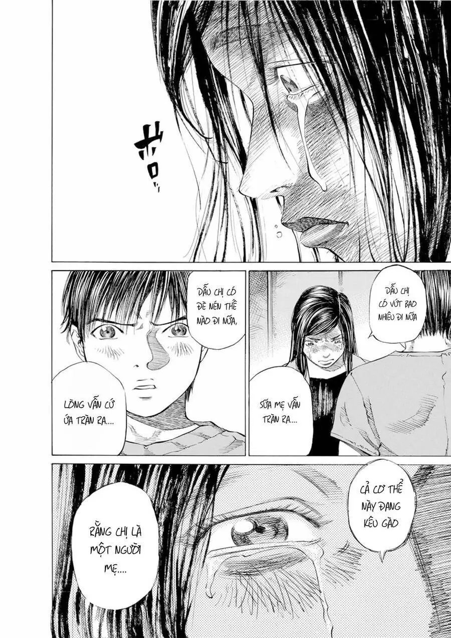 Give My Regards To Black Jack Nettruyen ZZZ Chương 25 Page 19